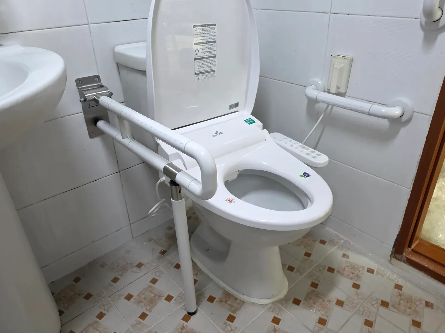 안전바 설치 비용, 이렇게 정해져요 시공 사진 1